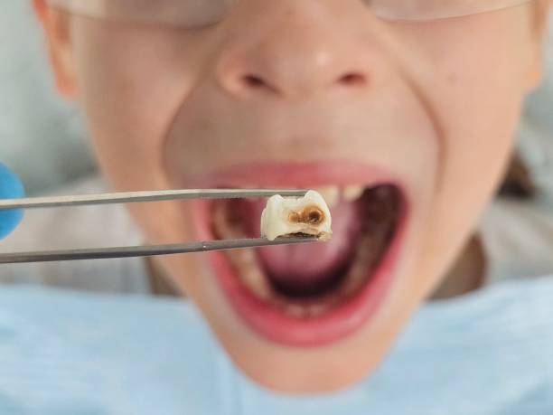 Best Emergency Treatment for Toothache in Arcadia, SC